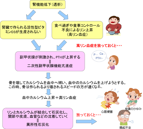 合併症(異所性石灰化)を防ごう