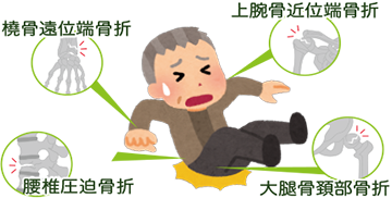 透析患者さんが骨折しやすい理由